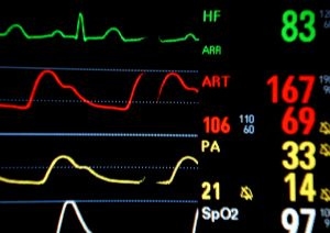 System Activity Monitor